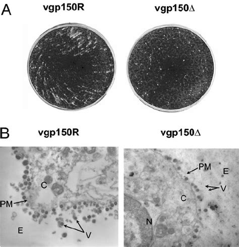 Plaque Morphology And Electron Microscopic Analysis Of Infected Cells