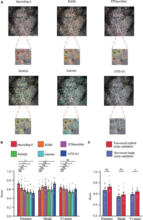 Frontiers Neuroseg Ii A Deep Learning Approach For Generalized