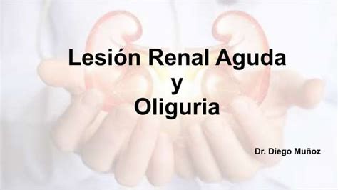 Lesi N Renal Aguda Final Pptx