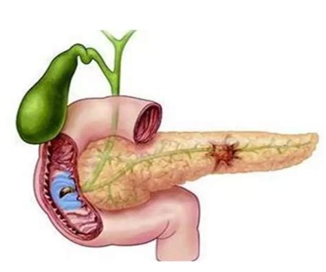 Pancreas Items | Syaf Unica Indonesia