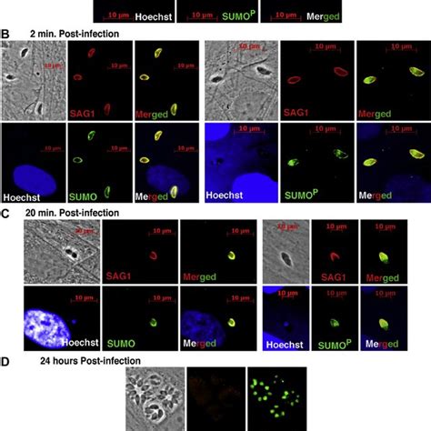 The Small Ubiquitin Like Modifier SUMO Conjugation Pathway In