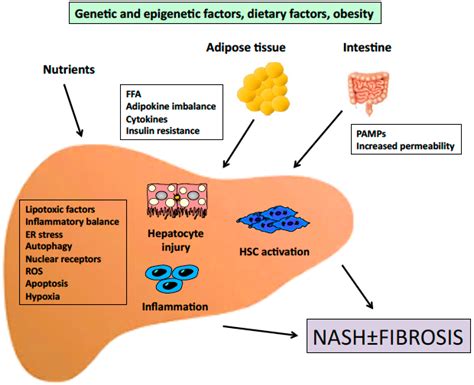 Ijms Free Full Text Molecular Pathogenesis Of Nash