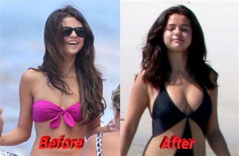 Selena Gomez Nose Job Plastic Surgery, Really?