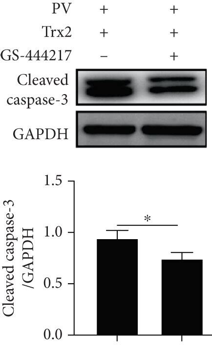 Trx2 ASK1 Signaling Mediates The Serum Induced KC Apoptosis In PV