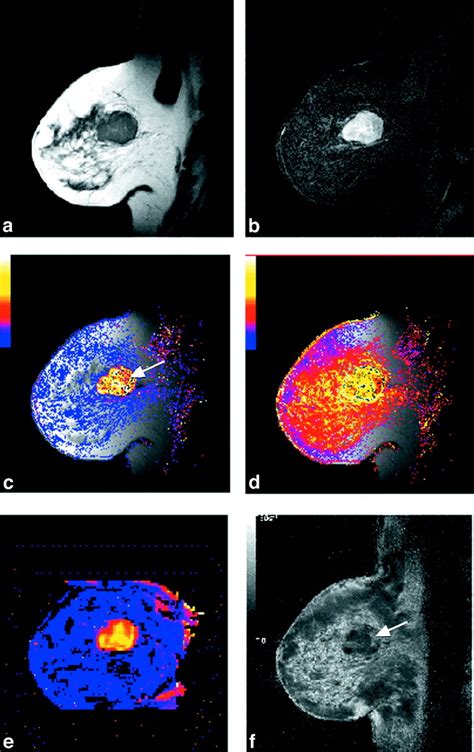 Dynamic Contrast‐enhanced Mri In Clinical Oncology Current Status And