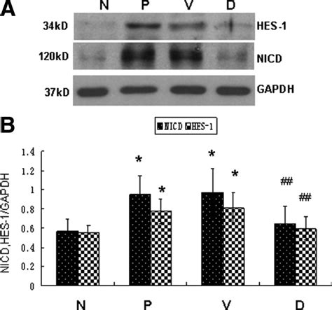 Effect Of Dapt On Inhibiting Notch Signaling Activation In Fibrotic