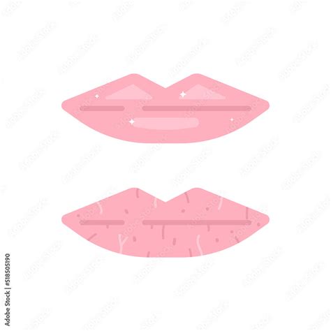 Healthy Lips And Dry Or Chapped Lips Lip Health Health Flat Cartoon