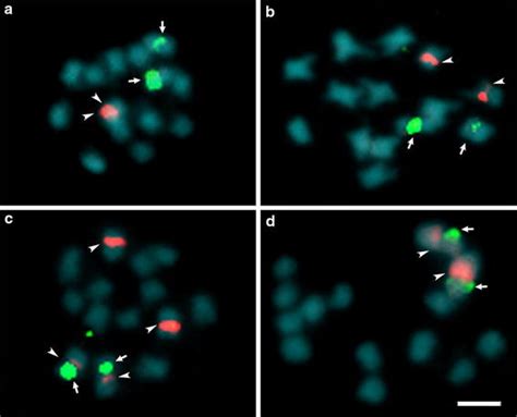 Fluorescence In Situ Hybridization With 45S Green And 5S Red RDNA