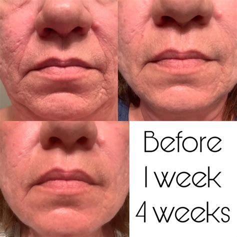 How Gail Aged Backwards Anti Aging Skincare Health Skin Care Anti