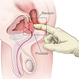 Orgasme Prostatique Les Hommes Aussi Ont Leur Point G