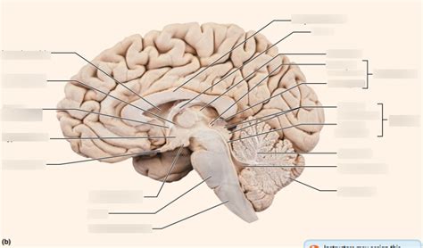 Anterior Commissure