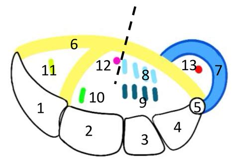 Diagramme de 305 CM10 Poignet et main Schéma 5 Canal carpien