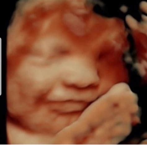 Miracle View 3d 4d Ultrasound 46 Photos And 65 Reviews Obstetricians And Gynecologists 3519 E