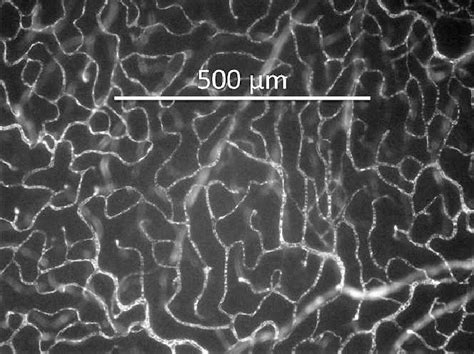 Retinal Flat Mount Showing Fitc Dextran Fluorescence In The