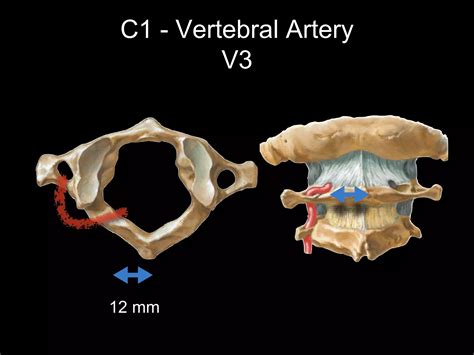 Applied Surgical Anatomy Of The Craniovertebral Spine PPT