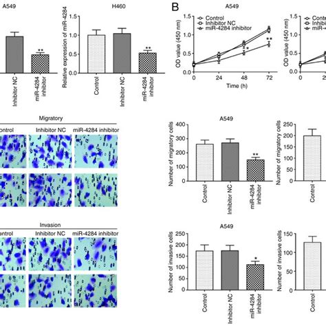 MiR 4284 Inhibition Suppresses Cell Proliferation Migration And