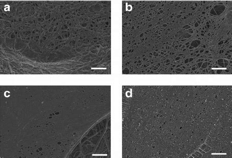 Morphology Of Fibrin Networks From Diseases Associated With