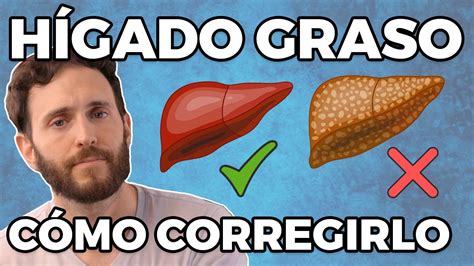 Como LIMPIAR EL HÍGADO naturalmente HÍGADO GRASO YouTube