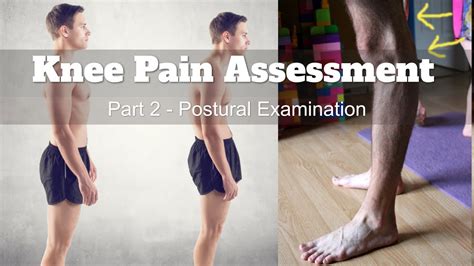 Knee Pain Assessment Part 2 Postural Examination YouTube