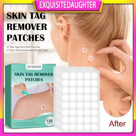 120PCS Box Warts Remover Patch Safe Painless Skin Tags Patches Pimple