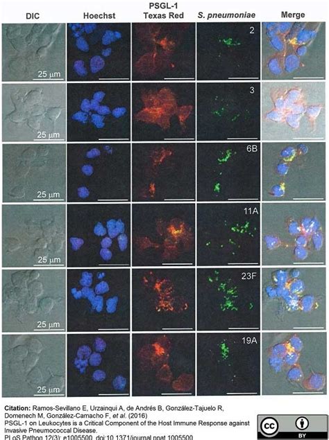 Anti Mouse IgG Antibody - Purified 1mg | Bio-Rad