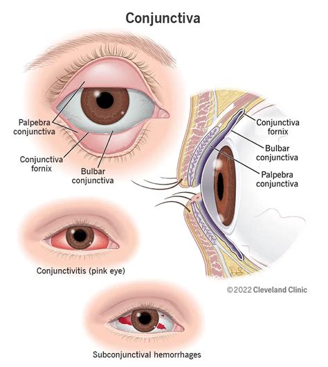 Eyelid Parts Of The Eyelid And How They Work Artofit