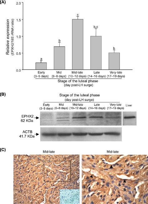 EPHX2 Expression And Immunolocalization In The Rhesus Macaque CL A