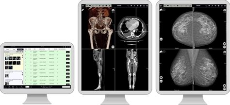 Extremepacs Ris And Pacs Radiology Workflow Is No Longer Under Your Control