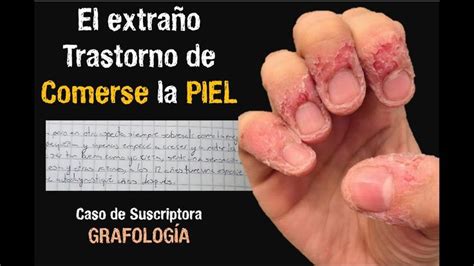 Una Suscriptora con Dermatofagia GRAFOLOGÍA Como adelgazar el