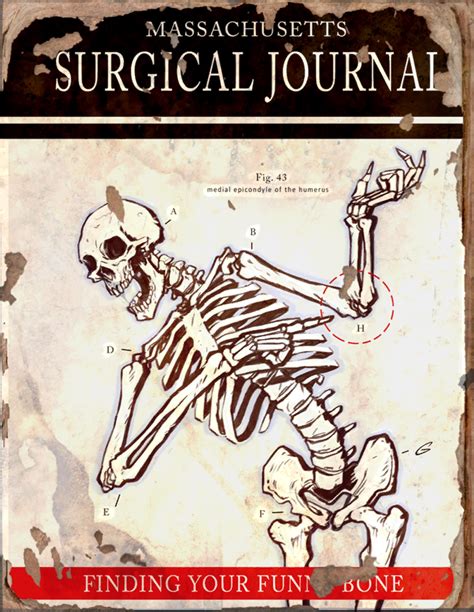 Massachusetts Surgical Journal Finding Your Funny Bone The Fallout Wiki