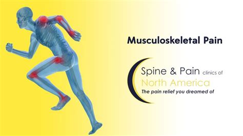 Musculoskeletal Pain Treatment In Fairfax Va And Potomac Md Sapna