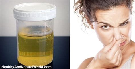 Bad Smelling Urine Causes Treatments And When To See A Doctor Odor Remedies Urinal Remedies