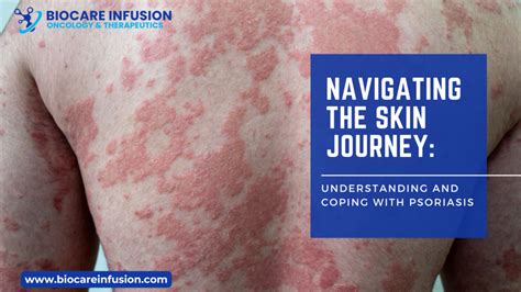 Navigating The Skins Journey A Guide To Skincare For Individuals Over