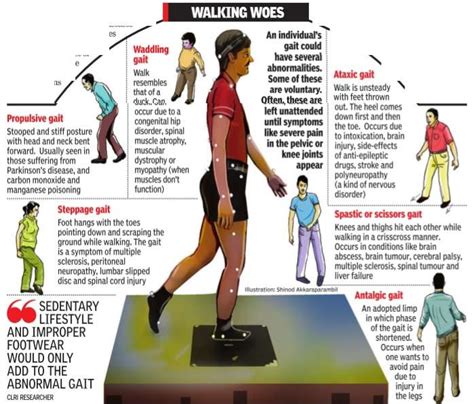 types of gait patterns Types of cane-supported gait using a weight ...