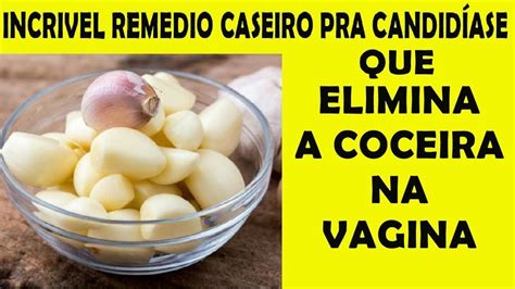 Coceira Na Vagina Remédio Caseiro REVOEDUCA