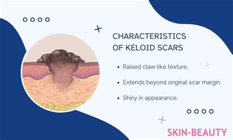 Complete Guide: Causes, Symptoms, and Treatment Options for Keloid Scars - USA Network X