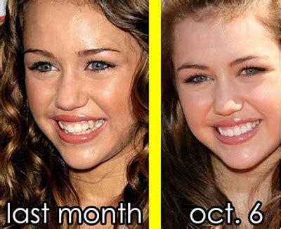 Miley Cyrus Teeth | Bad Teeth Pictures