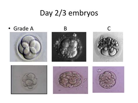 Oocyte and Embryo Grading blastocyst grading.pptx | Free Download