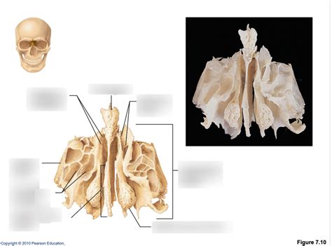 Ethmoid Bone Diagram Quizlet