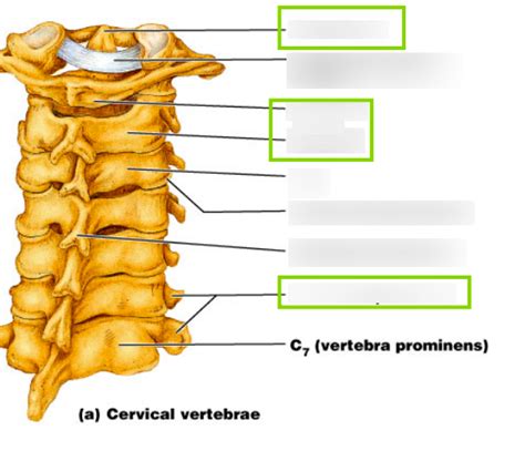 Cervical Vertebrae Atlas C1 And Axis C2 Diagram Quizlet