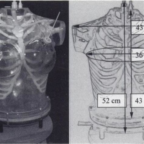 A Picture And Schematic Rep Resentation Of The Anthropomorphic Phantom Download Scientific