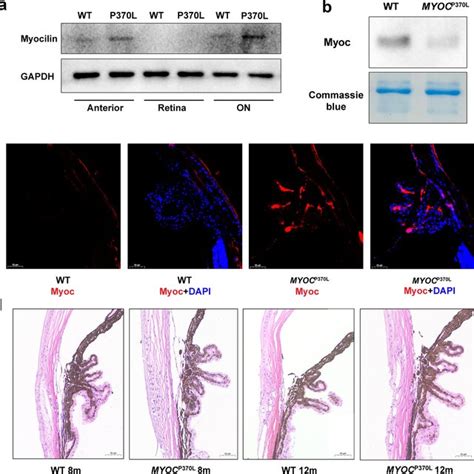 Generation And Identification Of Pro Leu Myocilin Mutation In