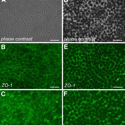 Rpe Cell Monolayer Development And The Establishment Of Barrier