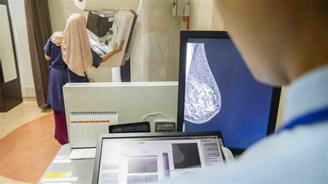 Screening Mammography Guidelines Johns Hopkins Medicine