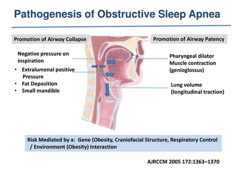 Ppt Upper Airway Pacing For Obstructive Sleep Apnea Powerpoint Presentation Id5938691