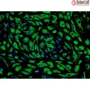 Sciencell Human Primary Endothelial Cells Team Medical Scientific