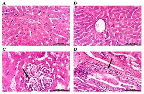 Photomicrograph Sections From Liver Of A Male Rabbit A Normal