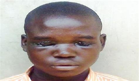 Bauchi Teens Eyes Gouged Out By Friend Daily Trust