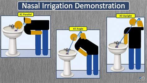 Nasal Irrigation Devices & Techniques For Illness, Allergies, & Wellness