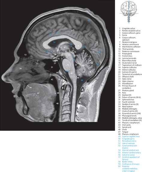 4 Sagittal Sections Radiology Key